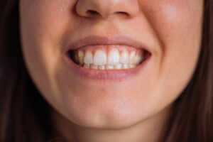 , Addressing your periodontal concerns