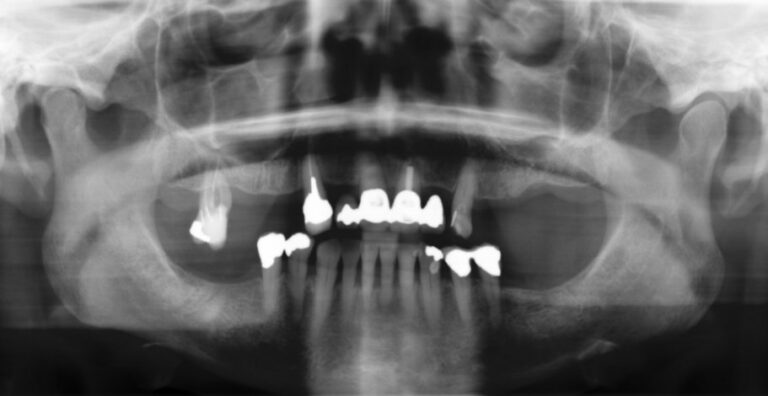 , Patient treatments