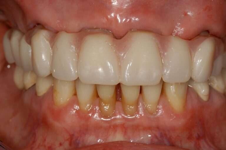 , Patient treatments