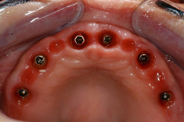 , Patient treatments