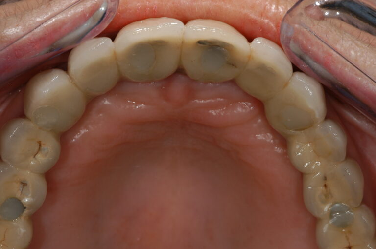 , Patient treatments