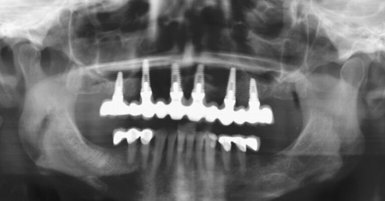 , Patient treatments