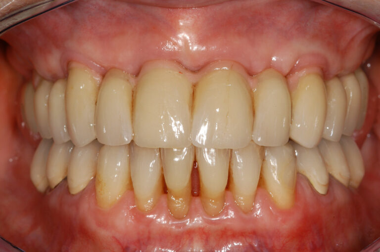 , Patient treatments